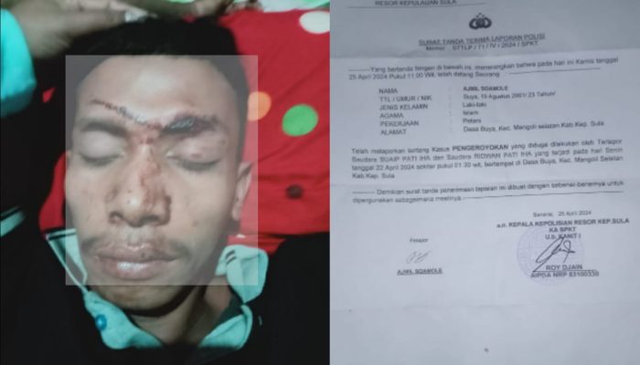 Diduga Jadi Korban Pengeroyokan Ajmil Didampingi Istri dan Keluarga Lapor Polisi