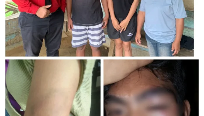 Kasus Penganiayaan Anak di Wosia Macet, Kuasa Hukum Desak Polres Halut Bertindak Tegas